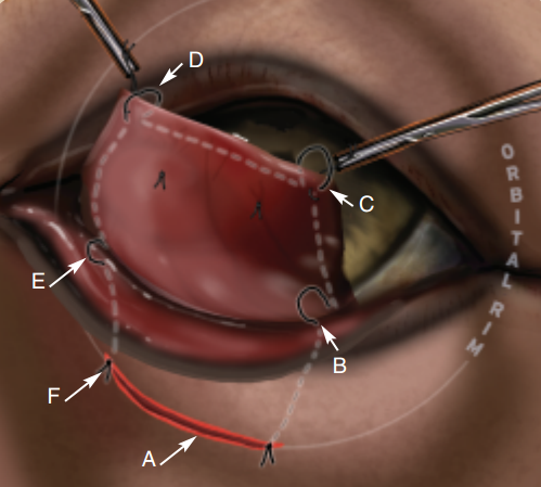 cherry eye treatment cherry eye disease cause treatment prevention veterinary hub cherry eye treatment cherry eye disease cause treatment prevention veterinary hub